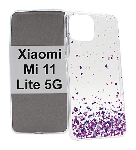 billigamobilskydd.se TPU-Designkotelo Xiaomi Mi 11 Lite / Mi 11 Lite 5G