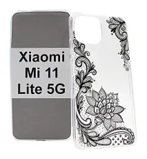 billigamobilskydd.se TPU-Designkotelo Xiaomi Mi 11 Lite / Mi 11 Lite 5G