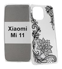 billigamobilskydd.se TPU-Designkotelo Xiaomi Mi 11