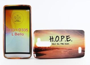 billigamobilskydd.se TPU Designcover LG L Bello (D331)