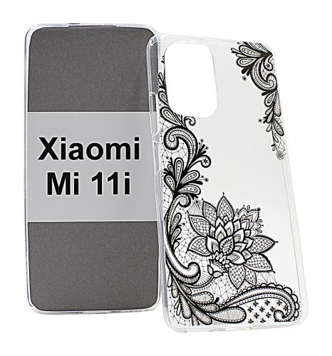 billigamobilskydd.se TPU-Designkotelo Xiaomi Mi 11i